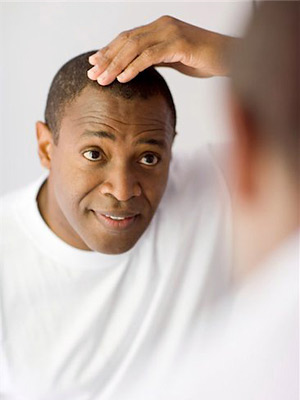 how to regrow a thinning hairline